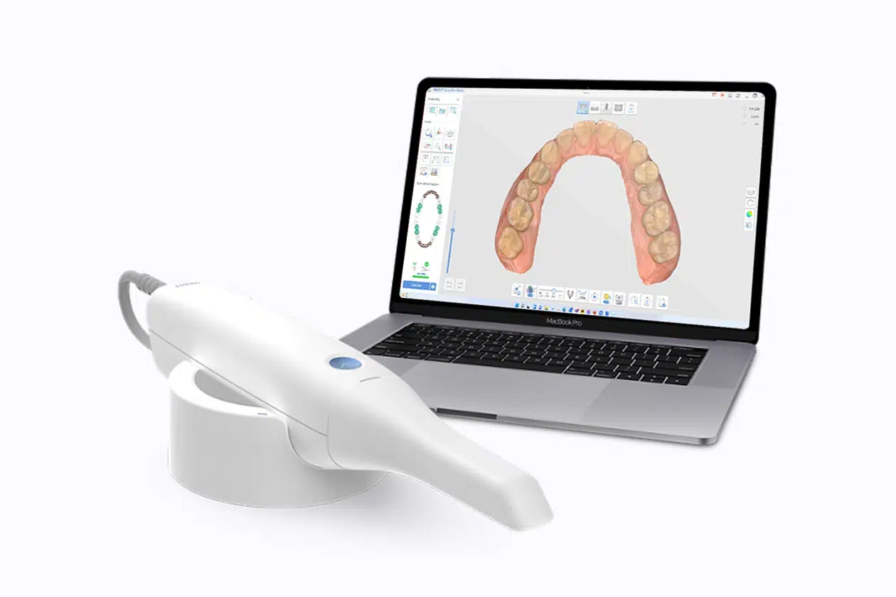 vitality dental dentist plano 3D-intraoral-scanner-medit