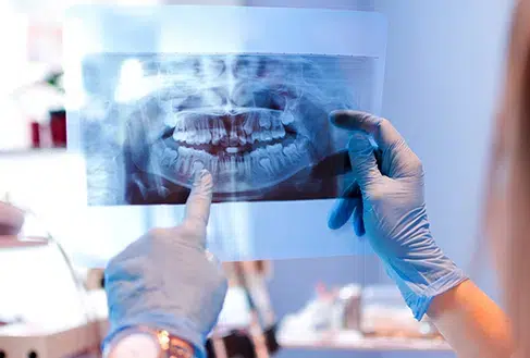 vitality dental dentist plano digital x-rays